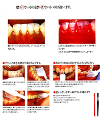 磨いているのと磨けているのは違います